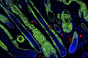 New Wound-Healing Biomaterials Reduce Scarring and Promote Tissue Regeneration