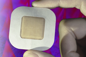 UCLA Researchers Develop Coin-Sized Smart Insulin Patch