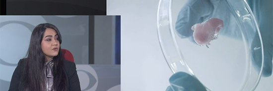 UCLA Expert Discusses Bioprinting