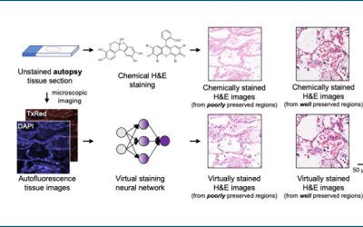 UCLA Unveils AI-Powered Autopsy Tissue-Staining Method Using Deep Learning