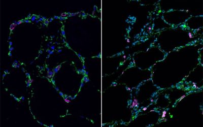 UCLA researchers use stem cells to grow 3-D lung-in-a-dish