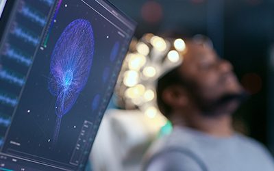 With $7M Grant From NIH, UCLA Scientists to Study if Brain Stimulation During Sleep Can Bolster Memory