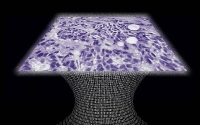Lens-Free Microscope can Detect Cancer at the Cellular Level