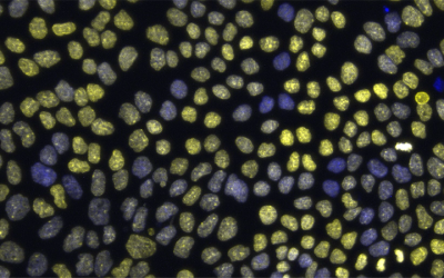 Does Cell Nucleus Size Matter in Gene Activity? Researchers Say Yes