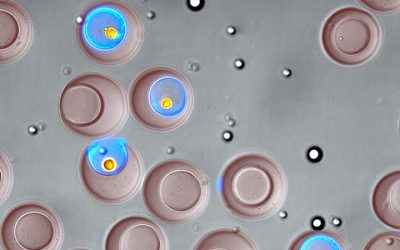 Advance in Immune Cell Screening Uncovers Receptors that Target Prostate Cancer