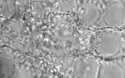 Ultrasound Offers New Avenue to Treat Diabetes