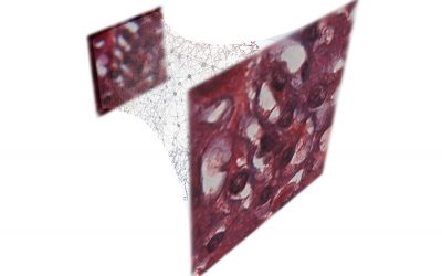 Deep learning to reconstruct holograms and improve optical microscopy