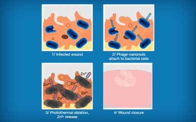 UCLA Engineers Develop Phage Therapy to Kill Bacteria