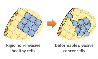 New Technique Improves Accuracy, Ease of Cancer Diagnosis