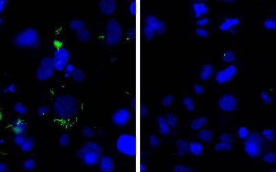 Researchers develop new drug combination technique to improve TB treatment