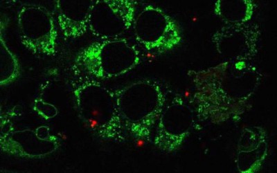 UCLA-led team develops new method to study mitochondrial DNA diseases