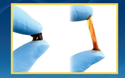 Mussels-Inspired Injectable Bioglue Offers Robust Sealing of Surgical Wounds