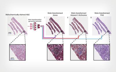 Artificial Intelligence Re-stained Images of Tissue Biopsy Expedite Diagnoses