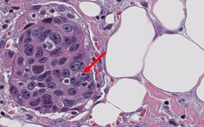 For faster and cheaper diagnosis, UCLA engineers are using deep learning to digitally stain tissue