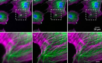 Deep learning takes fluorescence microscopy into super resolution