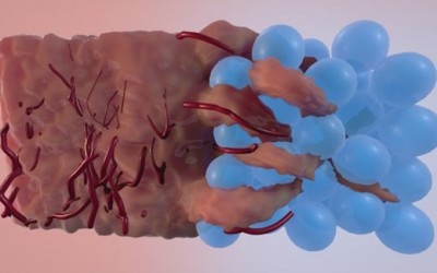 UCLA Researchers Develop New Material to Accelerate Healing
