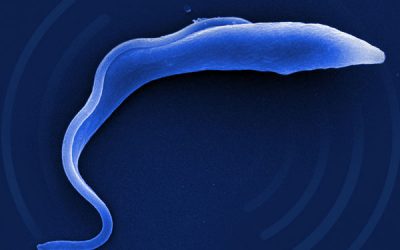 Artificial intelligence-based device detects moving parasites in bodily fluid for easier, earlier diagnosis