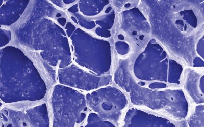 Sprayable gel developed by UCLA-led team could help the body fight off cancer after surgery