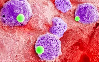 Two-cells-in-one combo could be platform to bolster leukemia treatment